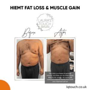 Before and After of a HIEMT Fat Loss and Muscle Gain client at Laura's Touch Clinic