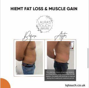 Before and After of a HIEMT Fat Loss and Muscle Gain client at Laura's Touch Clinic