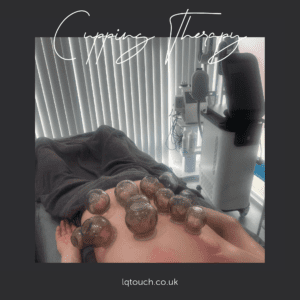 Cupping Therapy being administered to a client at Laura’s Touch, Bromley Clinic