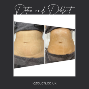 Before and After of a Detox & Debloat massage client at Laura's Touch, Bromley Clinic