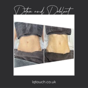 Before and After of a Detox & Debloat massage client at Laura's Touch, Bromley Clinic