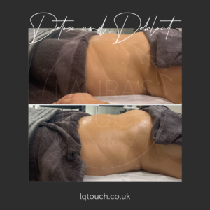 Detox & Debloat client at Laura's Touch, Bromley Clinic