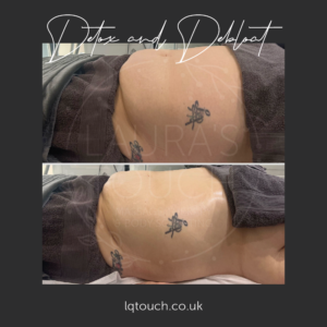 Detox & Debloat client at Laura's Touch, Bromley Clinic