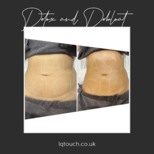 Detox & Debloat client at Laura's Touch, Bromley Clinic