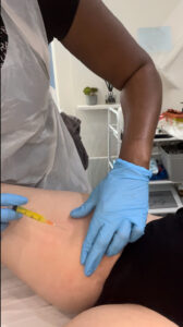 Laura administering Lemon Bottle Fat Dissolving Injections to a client at Laura's Touch, Bromley Clinic