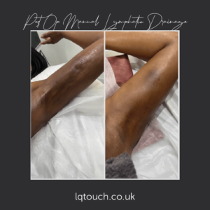 Post Op Manual Lymphatic Drainage