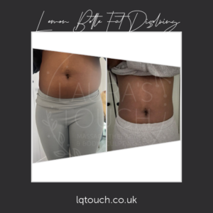 Before & After x3 Lemon Bottle Fat Dissolving Injections