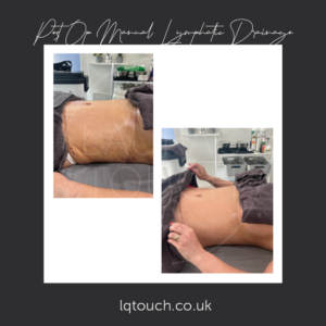 Post Op Manual Lymphatic Drainage