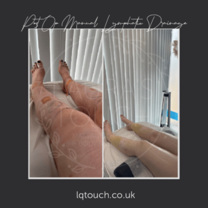 Post Op Manual Lymphatic Drainage Client