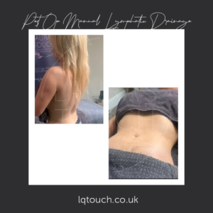 Manual Lymphatic Drainage Focused on back, waist and hips.