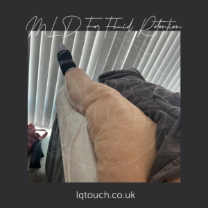 Client having regular MLD to manage the condition Lipoedema