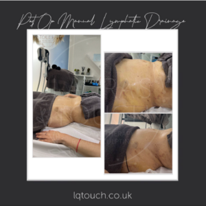 Post Op Manual Lymphatic Drainage Client